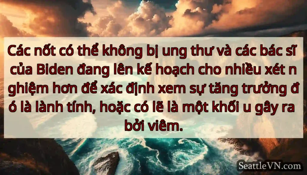 Các nốt có thể không bị ung thư và các bác sĩ của