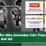 Ăn Não Amoeba Cẩn Trọng Khi Bơi Hồ
