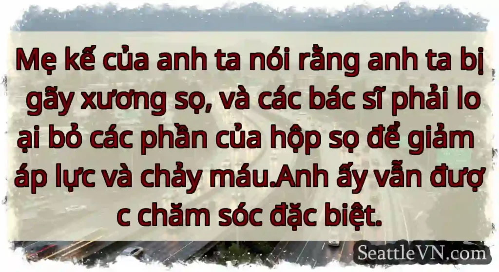 Mẹ kế của anh ta nói rằng anh ta bị gãy xương sọ,