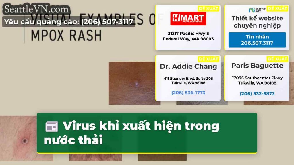 Virus khỉ xuất hiện trong nước thải
