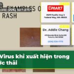 Virus khỉ xuất hiện trong nước thải