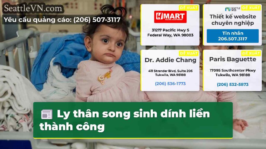 Ly thân song sinh dính liền thành công