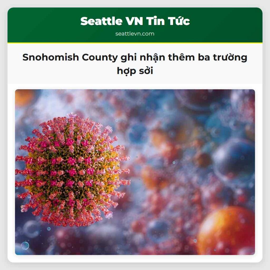 Snohomish County ghi nhận thêm ba trường hợp sởi
