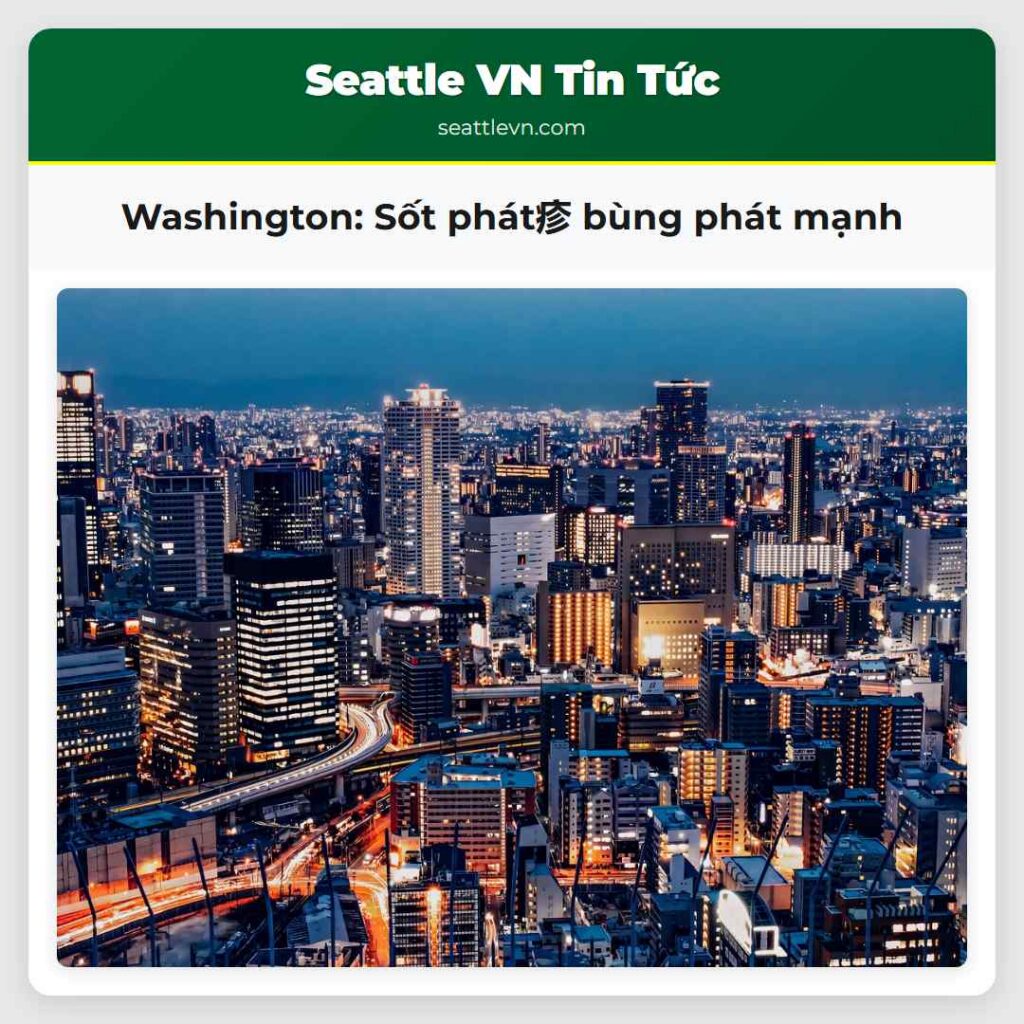 Washington: Sốt phát疹 bùng phát mạnh