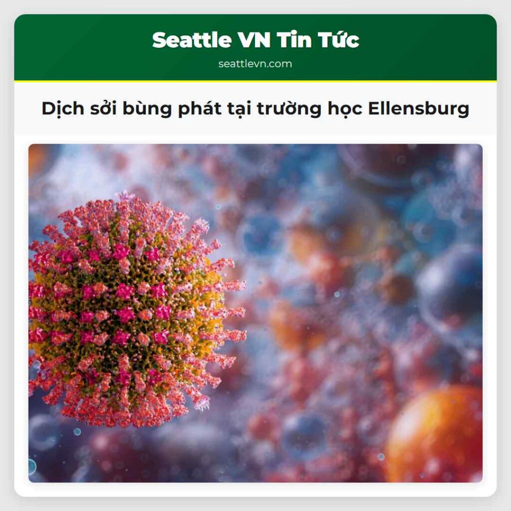 Dịch sởi bùng phát tại trường học Ellensburg