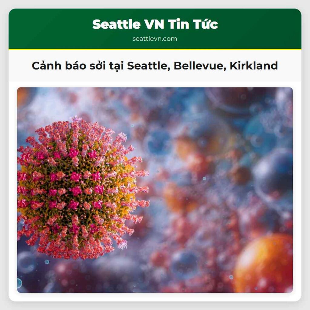 Cảnh báo sởi tại Seattle, Bellevue, Kirkland